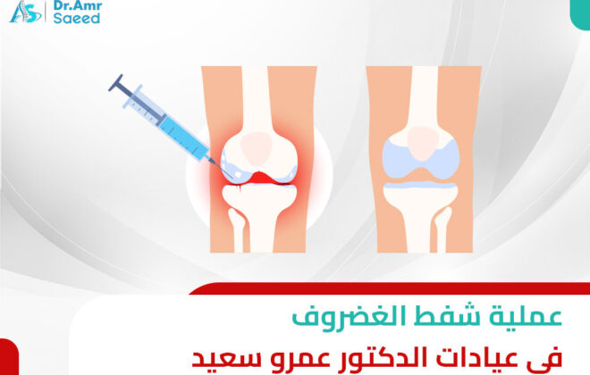 سعر عملية شفط الغضروف في عيادات الدكتور عمرو سعيد