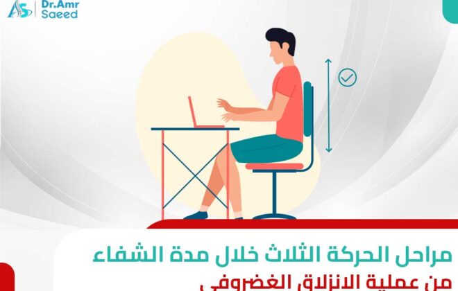 مدة الشفاء من عملية الانزلاق الغضروفي